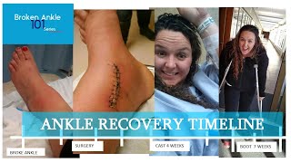 Ankle Recovery Timeline - Broken Ankle 101 - covering the timeline of crutches, casts, surgery, etc.