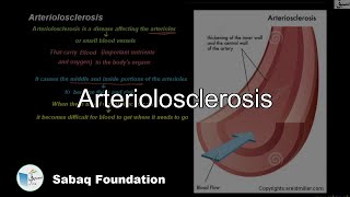 Arteriolosclerosis