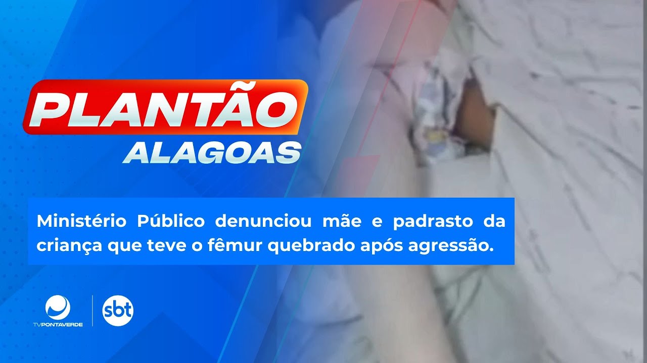 Minist&eacute;rio P&uacute;blico denunciou m&atilde;e e padrasto da crian&ccedil;a que teve o f&ecirc;mur quebrado ap&oacute;s agress&atilde;o.