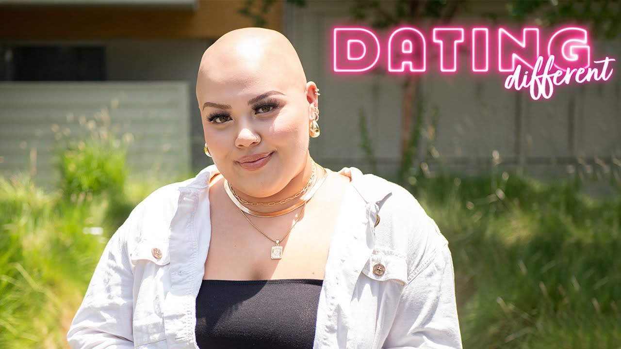 I think my bald head is sexy - but will my blind date? - dating different