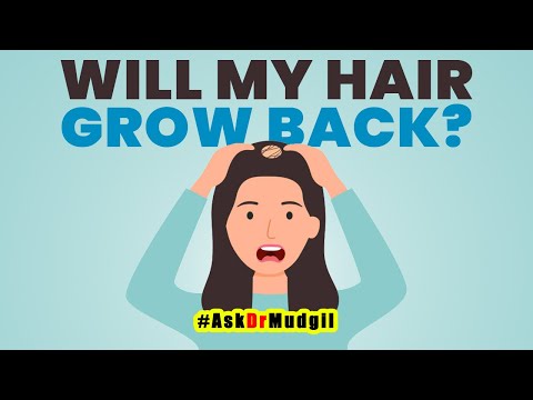 WILL MY HAIR GROW BACK?