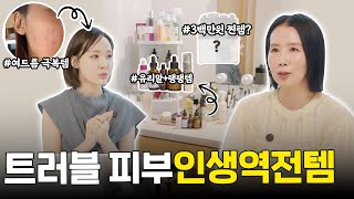 드디어 구독자님 집 방문!!  여드름 극복 N차 재구매템과 꿀피부 루틴 싹 다 알려줌 by 디렉터파이