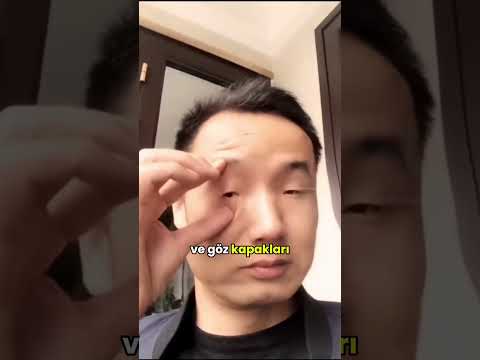 Çinli Çocuklarda Görülen Bpes Sendromu Nedir? 👀