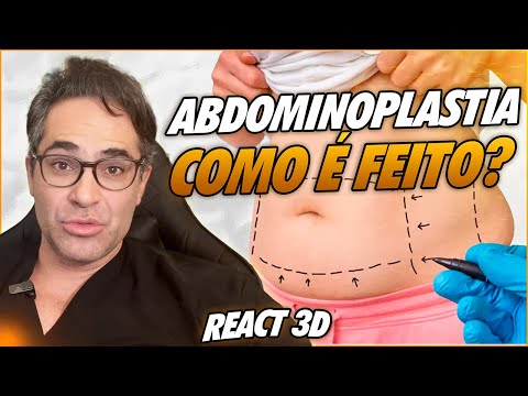 ABDOMINOPLASTIA APÓS A GRAVIDEZ? DESCUBRA COMO ESSE PROCEDIMENTO PODE TE AJUDAR!