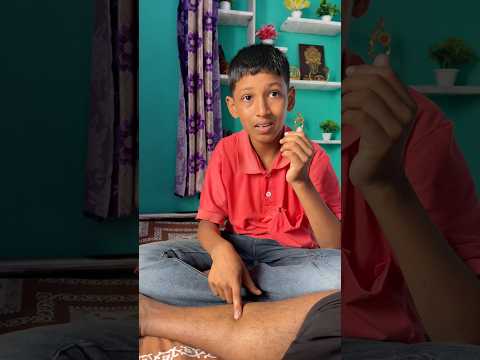 আমার পা টাকে কেটে ফেলে দিতে হবে 😊#minivlog #vlogs