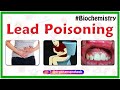 Lead Poisoning: Symptoms and Treatment