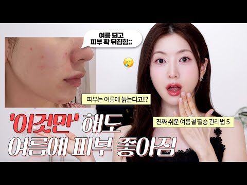 여름에 피부 젤 늙음😭 오히려 피부 좋아지는 5가지 관리법! | 여름 기초필수템, 간과하는 OO관리!?, 진짜 쉬운 습관공유