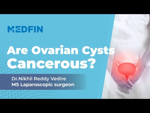 How can I Treat Ovarian Cysts?