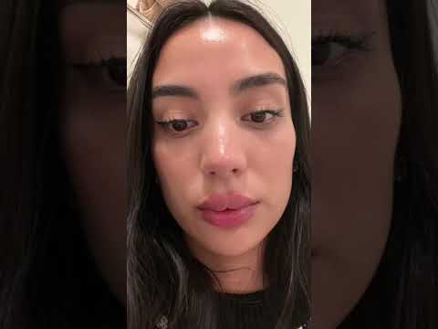 ME INYECTE LOS LABIOS 👄 Y SALIÓ MAL 😩.... bueno no tan mal 😂 Ácido hialurónico en labios