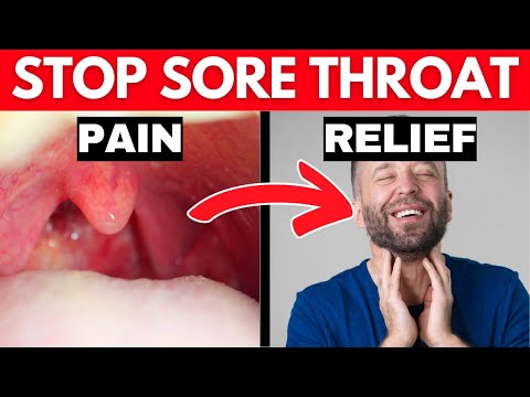 10 Natural Cures for Sore Throat