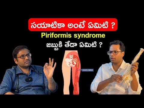 Sciatica? How to Identify Nerve Pain in Back & Legs ? Dr Ramprasad X@SrinivasaNeuroCenter