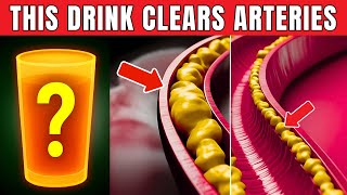 1 Drink That ELIMINATE BAD CHOLESTEROL, Open Arteries and PREVENT STROKE