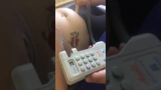 Baby heart beat