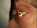 Zebrafish and Vision Research