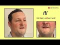Understanding the Word 'Fat'