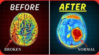 Dr Joe Dispenza - How to ACTUALLY Reprogram your Brain
