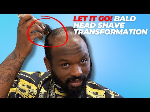 Let It Go! Knowing When to Go Bald!