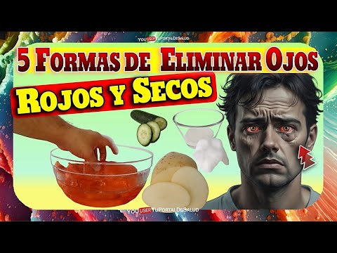 ¿Cansado de Ojos Hinchados y rojos? 5 Trucos para Aliviar los Ojos Cansados