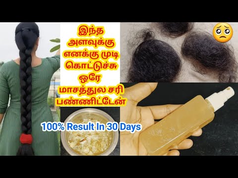 🔥🔥30 நாட்களில் அடர்த்தியான நீளமான முடி பெற 💯%Natural Remedies/ Hair Growth Tips #cloveswaterforhair