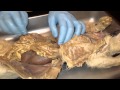 Human Digestive System Functions and Anatomy