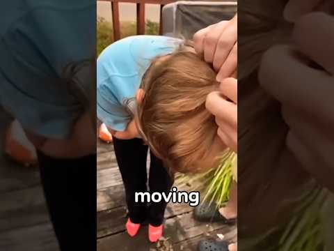 They Found the Creature Hidden in the Woman's Hair  😨