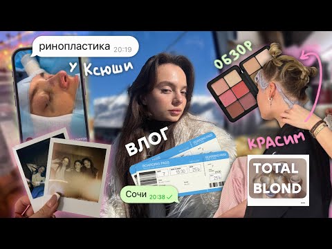Влог: Ринопластика Ксюши 👃, красим в блонд 💇🏼‍♀️, Сочи New Star Camp 🏂, Покупки 🛒, концерт Toxi$ 🎤