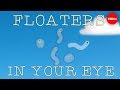 Understanding Visual Phenomena: Floaters and Blue Field Entoptic Phenomenon