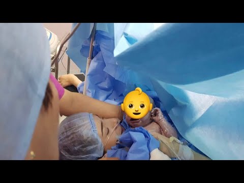 MY DELIVERY STORY / قصة ولادة إبني