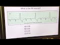 Measuring PR Intervals in ECG