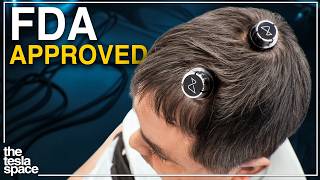 Neuralink Reveals New BLINDSIGHT Implant!
