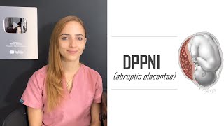 Desprendimiento prematuro de Placenta DPPNI #ginecologia #obstetricia | Mentes Médicas