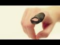 Orthosis Creation and Application Steps