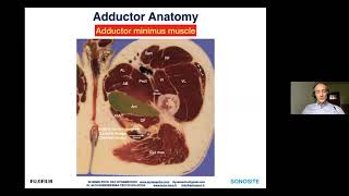 Webinar:Echographie des traumatismes musculaires aigus chez le sportif:Adducteurs & Ischios jambiers