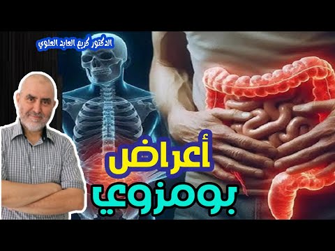 أعراض تخبرك أنك مصاب بمرض بومزوي   -   الدكتور كريم العابد العلوي  -