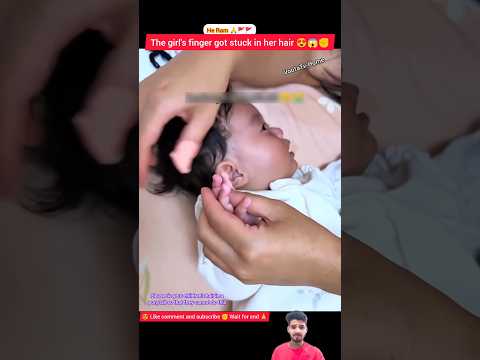 Baby’s Finger Stuck in Hair 😱 Mom Saved Instantly ❤️ #shorts #viralvideo #youtubeshorts