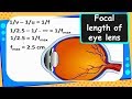 Understanding the Focal Length of the Human Eye