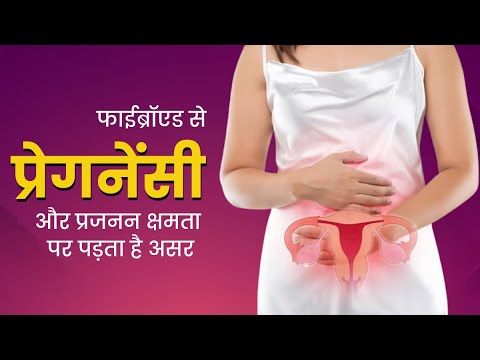 आपके मां बनने का सपना छीन सकती है गर्भशय की गांठ-गर्भाशय की गांठ फर्टिलिटी को कैसे प्रभावित करते हैं