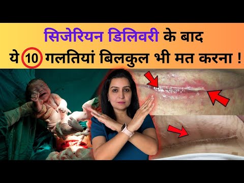 सिजेरियन डिलिवरी के बाद ये 10 गलतियां बिलकुल भी मत करना | Care After Cesarean Delivery