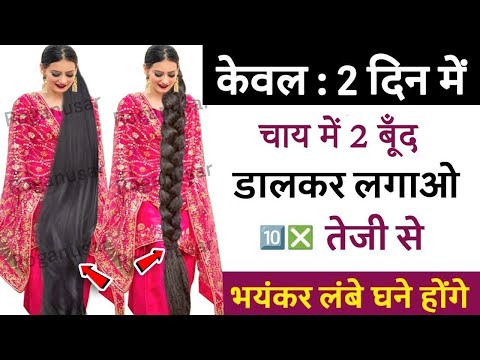 गंजे होने से कोई बचा नहीं सकता है अगर ये Secret पता नहीं चला तो, क्योंकि 99% लोग जानते ही नहीं है