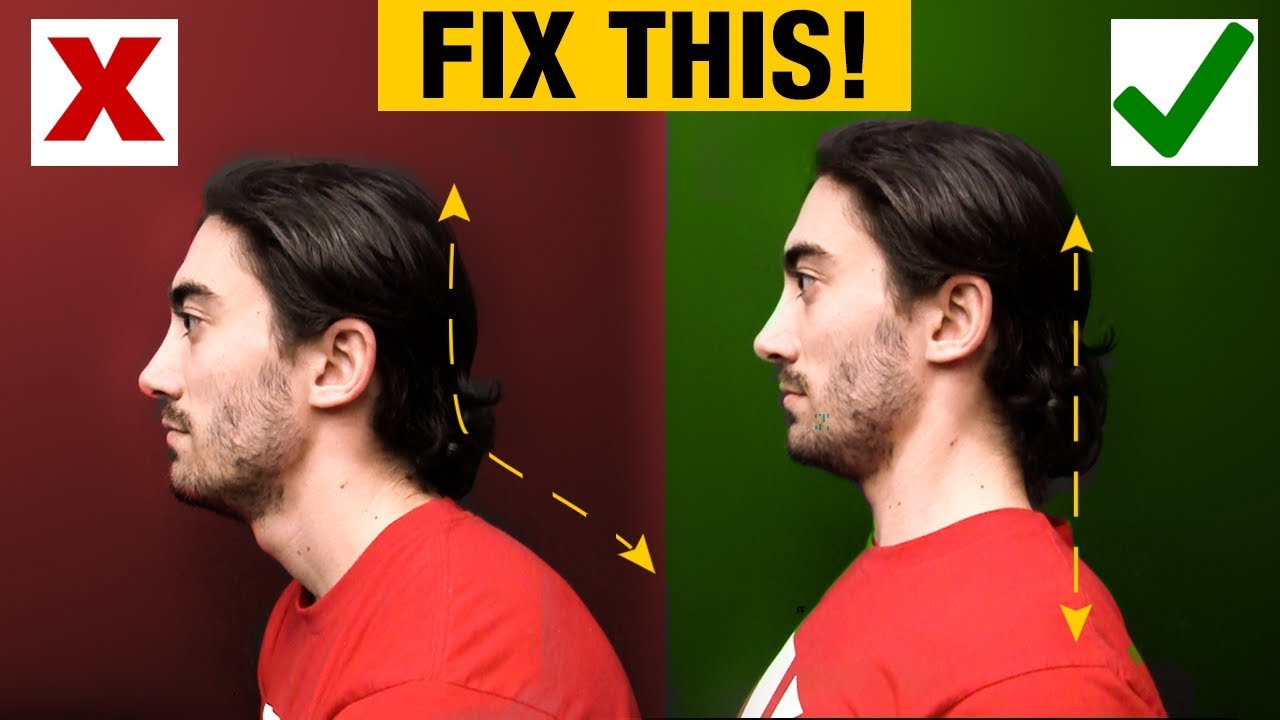 How to Fix Forward Head - Slumped Posture (PERMANENTLY)