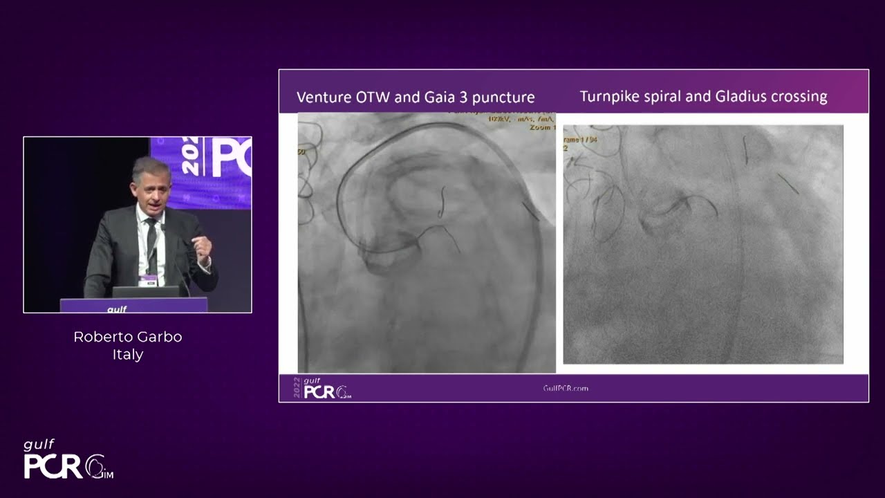 Complex CTOs in CHIP