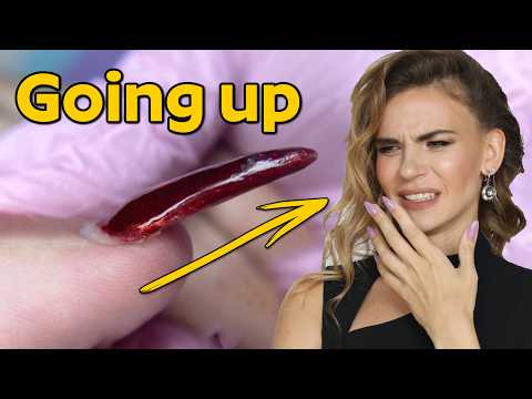 Nails Grow Upwards - How to Fix it!? Nail Transformation Tutorial