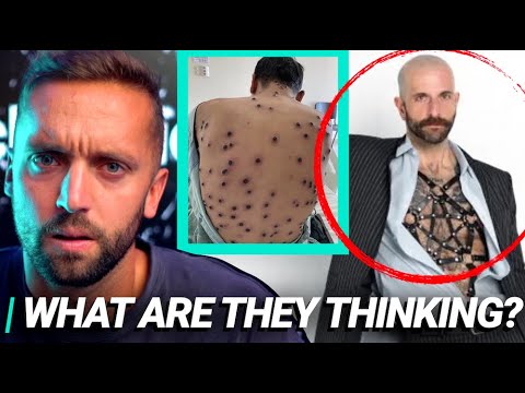 Monkey Pox: The Dark Truth Behind The New Pandemic | Kap Reacts