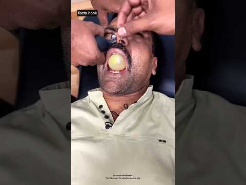 Stop eating chewing gum