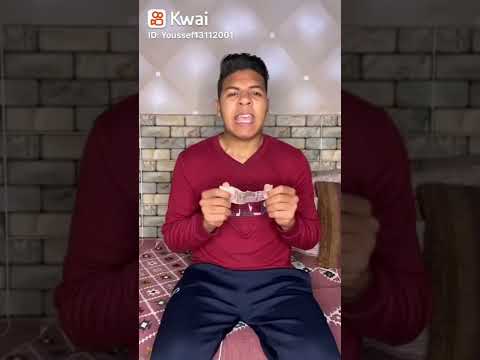 لما تقصف جبهتك وانت مش واخد بالك 😂💙/يوسف جو