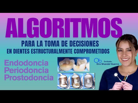 Algoritmos para la toma de decisiones en dientes comprometidos 🦷 con Dra Shandel Guerra Barba