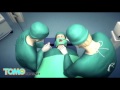 Download Video Pasien Tersadar Selama Operasi, Merasakan Dan Mendengar Percakapan Dokter 02 Download Video Pasien Tersadar Selama Operasi, Merasakan Dan Mendengar Percakapan Dokter 02