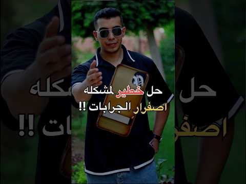 حل خطير لاصفرار الجرابات ❌