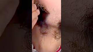 വെറും ഒരാഴ്ച കൊണ്ട് താടി വളർത്താം😱Beard fast glowing tips #tips #shorts