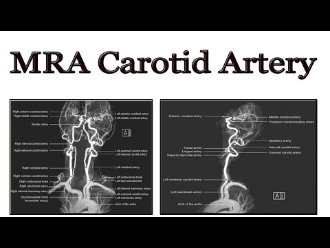 Mra Vertebral Artery Cpt Code - 08/2021 image.